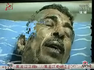 埃及男子议会前自焚抗议生活窘迫