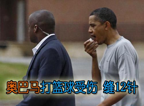 美总统奥巴马打篮球受伤缝12针