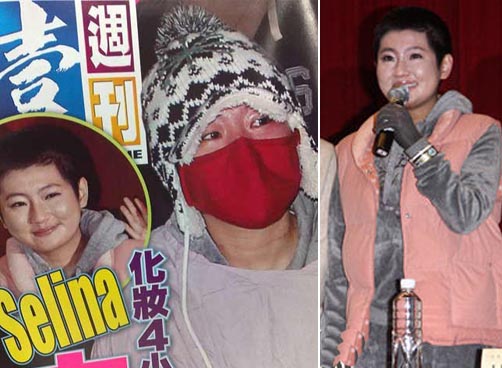 Selina伤后素颜照首度曝光，烧伤求偿无门？