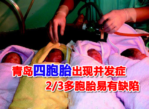 三分之二多胞胎是辅助生殖，专家建议自然怀孕