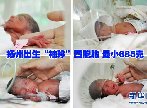 “袖珍”四胞胎 最小685克