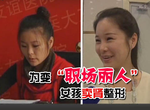 因找不到工作徐州女孩卖肾整容 已成为职场女性